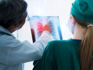 Συμπτώματα Χρόνιας Αποφρακτικής Πνευμονοπάθειας (ΧΑΠ)