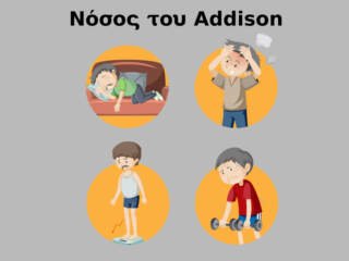 Νόσος του Addison