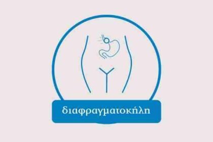 Διαφραγματοκήλη