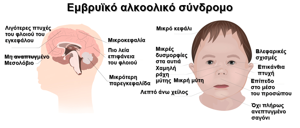 alko2