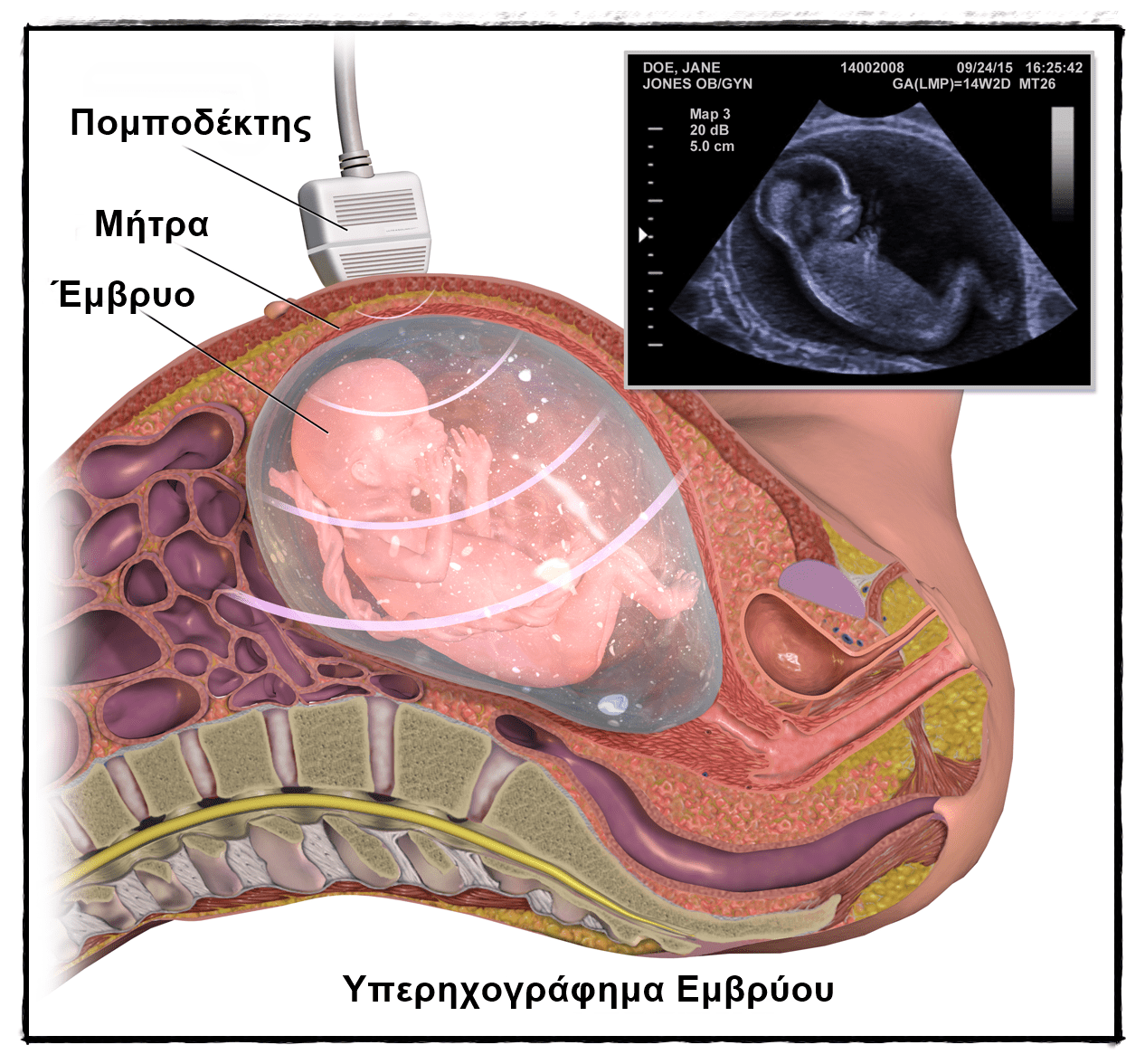 Υπερηχογράφημα Εμβρύου