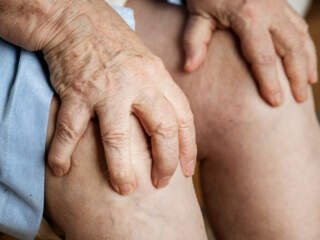 Ουρικό Οξύ: Αιτίες, κίνδυνοι, θεραπεία, πρόληψη