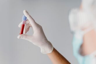 Τι σημαίνουν τα ανεβασμένα λευκά αιμοσφαίρια στην αιματολογική εξέταση