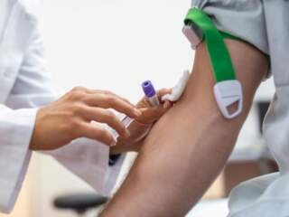 Εξετάσεις ηπατικής λειτουργίας: Πότε χρησιμοποιούνται;
