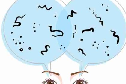 Μυγάκια στα μάτια