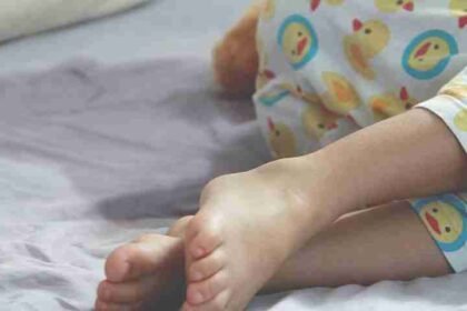 Παιδιατρική ακράτεια ούρων