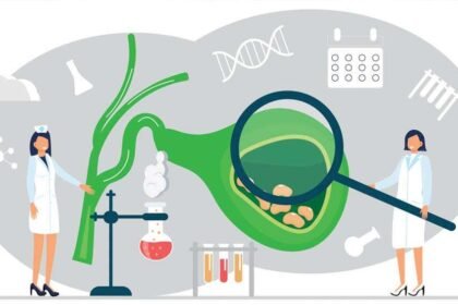 Πέτρες στη χολή