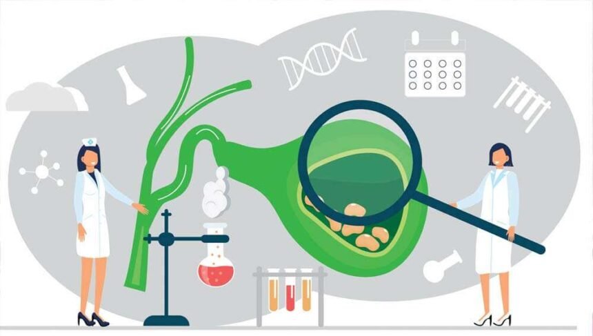 Πέτρες στη χολή (χολολιθίαση). Ποιες είναι οι αιτίες; 21 Πέτρες στη χολή