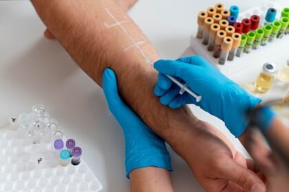 Αναφυλαξία