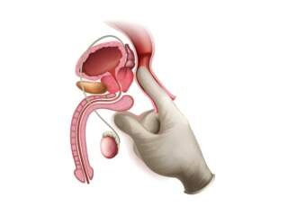 Εξέταση προστάτη