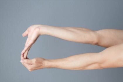 Σύνδρομο Marfan