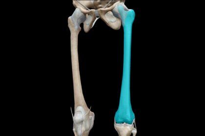 Μηριαίο Οστό