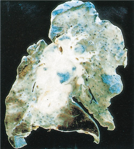 k3 1