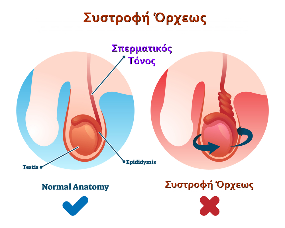 Τραυματισμός στους όρχεις