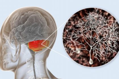 Παρεγκεφαλίδα