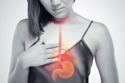 Καούρες: 8 συμβουλές για την πρόληψη της καούρας