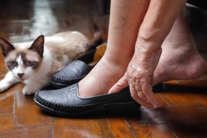 Πρησμένα Πόδια: 5 λόγοι για τους οποίους τα πόδια σας μπορεί να είναι πρησμένα και τι να κάνετε γι' αυτό