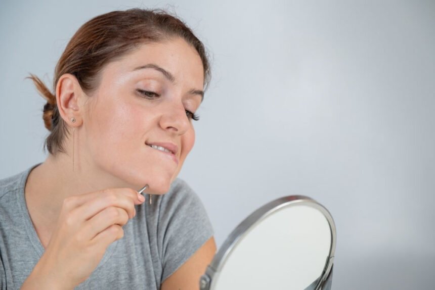 H υπερτρίχωση (έντονη τριχοφυία) στο πρόσωπο της γυναίκας δεν είναι μόνο αισθητικό πρόβλημα 21 υπερτρίχωση