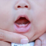 α πρώτα δόντια του μωρού (οδοντοφυΐα) ΔΕΝ προκαλούν πυρετό