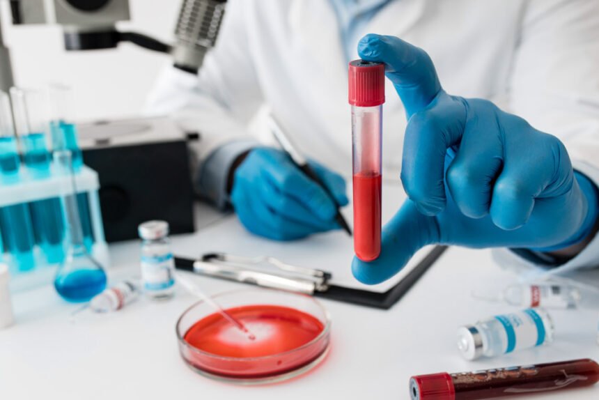 Εξετάσεις αίματος για τον καρκίνο. Μπορείτε να εντοπίσετε τον καρκίνο με μια εξέταση αίματος 21 Εξετάσεις αίματος για τον καρκίνο. Μπορείτε να εντοπίσετε τον καρκίνο με μια εξέταση αίματος