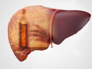 liver