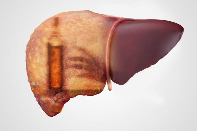 liver