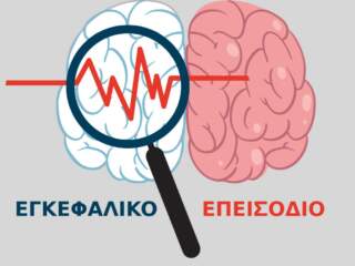 Εγκεφαλικό επεισόδιο