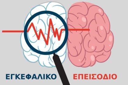 Εγκεφαλικό επεισόδιο