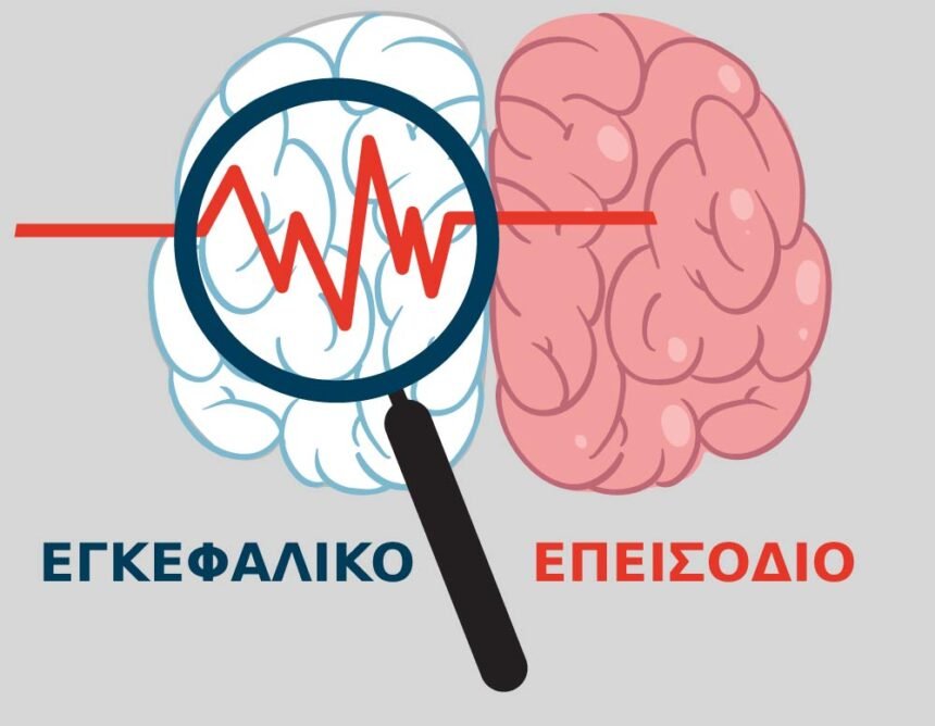 Εγκεφαλικό επεισόδιο