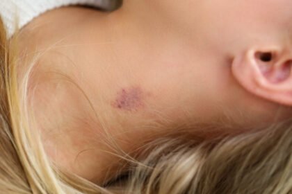 Πώς να απαλλαγείτε από μία… ρουφηξιά (πιπιλιά)