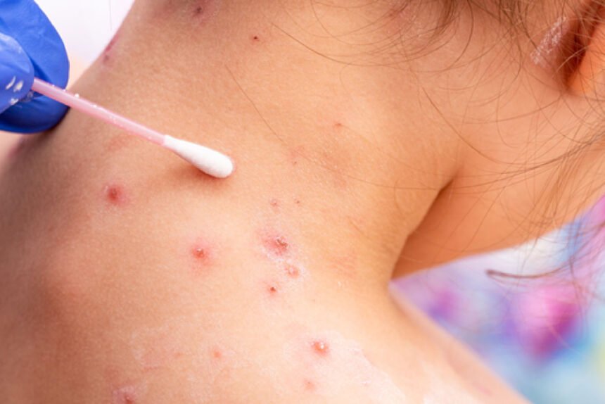 Για ποιο χρονικό διάστημα μεταδίδεται ένας ιός