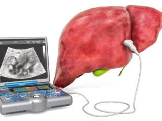 yperoxos ipar