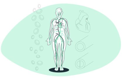 Περιφερική Αρτηριακή Νόσος