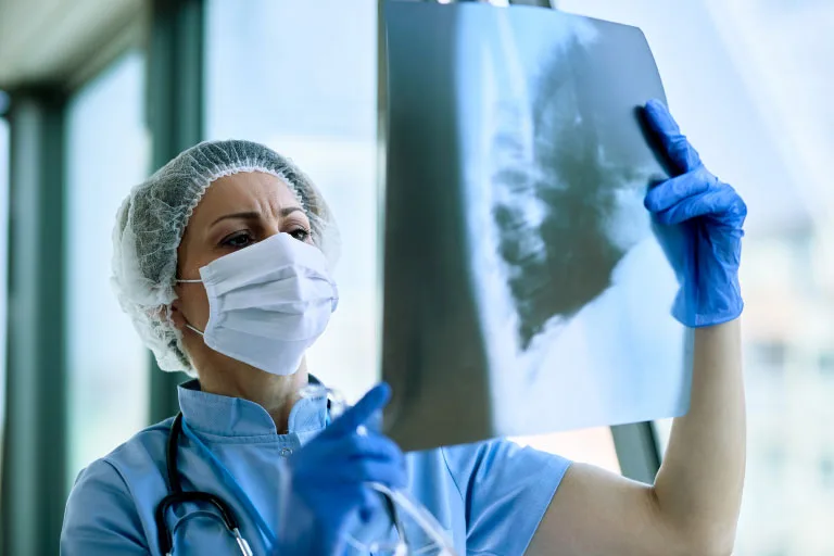 pneumonia Τα τέσσερα στάδια της πνευμονίας