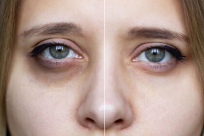 Μαύροι κύκλοι