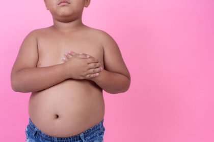 Οι γονείς πρέπει να δράσουν έγκαιρα απέναντι στην παιδική παχυσαρκία