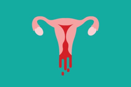 Κολπική αιμορραγία