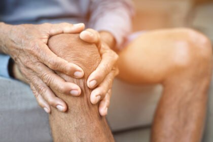 Ανακάλυψε τα κυριότερα σημεία και συμπτώματα της οστεοαρθρίτιδας. Μάθε πώς να αναγνωρίσεις τα πρώτα σημάδια και πότε να επισκεφτείς το γιατρό σου για διάγνωση και θεραπεία.