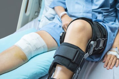 Μάθετε για την αποκατάσταση μετά από εγχείρηση μηνίσκου. Συμβουλές και βήματα για πλήρη ανάρρωση, με έμφαση στην αποφυγή επιπλοκών και τη βελτίωση της κινητικότητας του γόνατος.