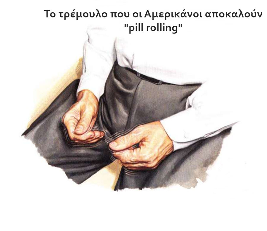 Τρέμουλο στα χέρια: Γιατί τρέμουν τα χέρια σας; 22 Τρέμουλο στα χέρια