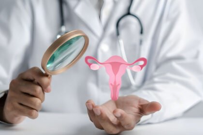 Καρκίνος των ωοθηκών